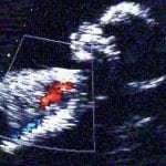 Ecocardiografía fetal
