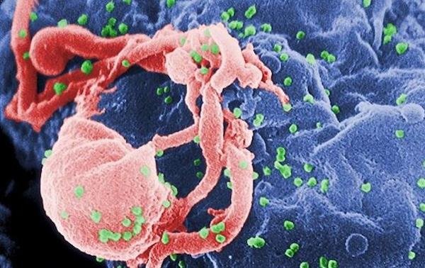 Cuba se convirtió en el primer país en eliminar la transmisión del virus del SIDA de madre a hijo