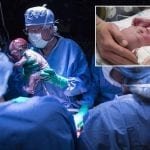 Nació el primer bebé de un trasplante de útero realizado en Estados Unidos