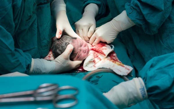 Una mamá demanda a un hospital por haberle realizado una cesárea sin anestesia